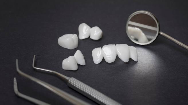 Several dental crowns and veneers on table next to dental mirrors