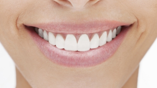 Close up of person smiling with straight white teeth