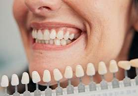 a shade chart being held in front of a woman’s smile