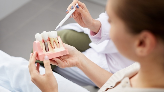 Dentist showing a dental implant model to a patient