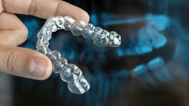 Hand holding an Invisalign aligner