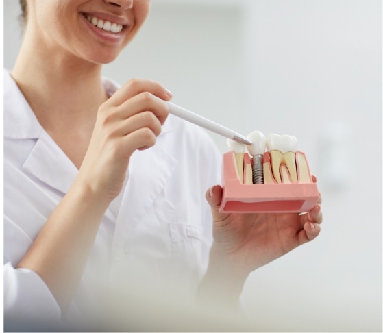 doctor showing patient a dental implant