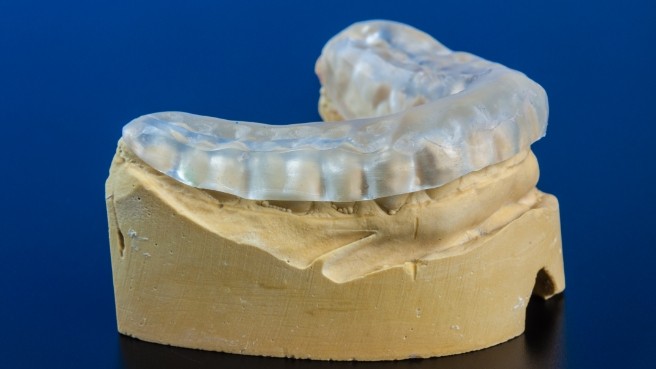 Model of lower teeth with clear nightguard on top