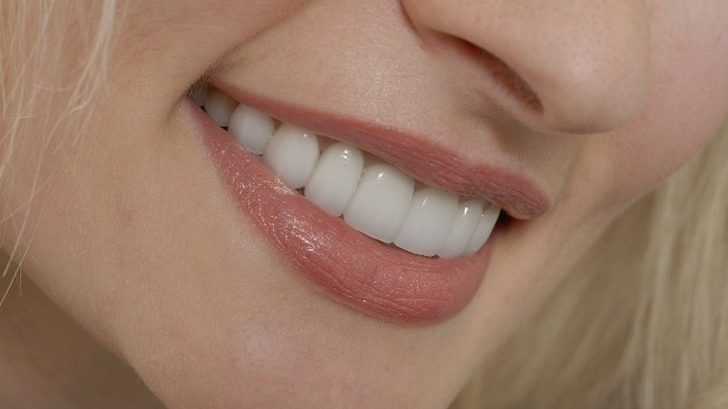 Close up of smile with straight white teeth