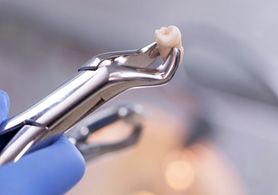 dental forceps holding an extracted tooth