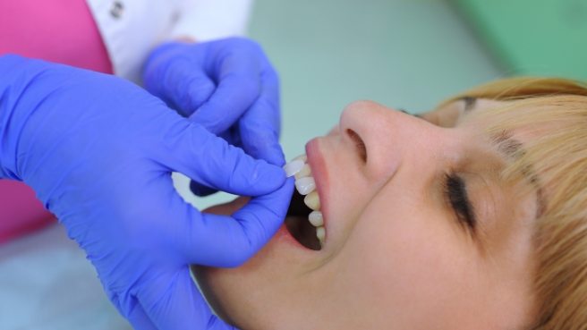Woman receiving dental veneer from Irving cosmetic dentist