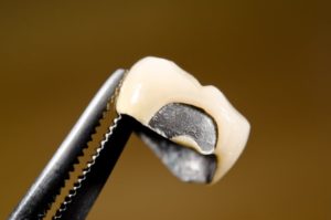 dentist holding up a dental crown that's broken