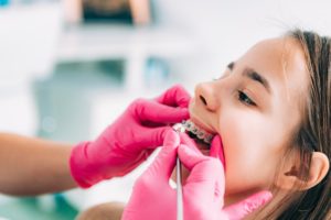 a dentist cleaning a patient's braces