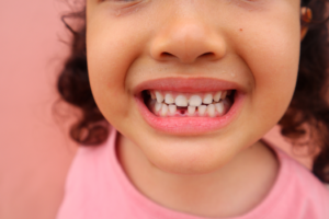 a child with a gap between their teeth